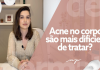 Espinha nas costas como tratar? Remédios caseiros e dicas eficazes!