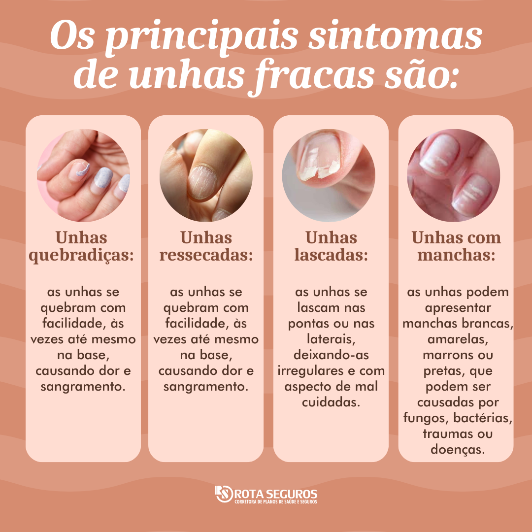 Unhas fracas e quebradiças nunca mais! 5 dicas infalíveis para você.