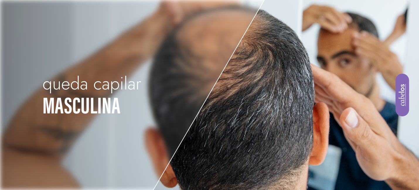 Queda de cabelo masculino: como evitar? (Experts dão o papo reto aqui!)