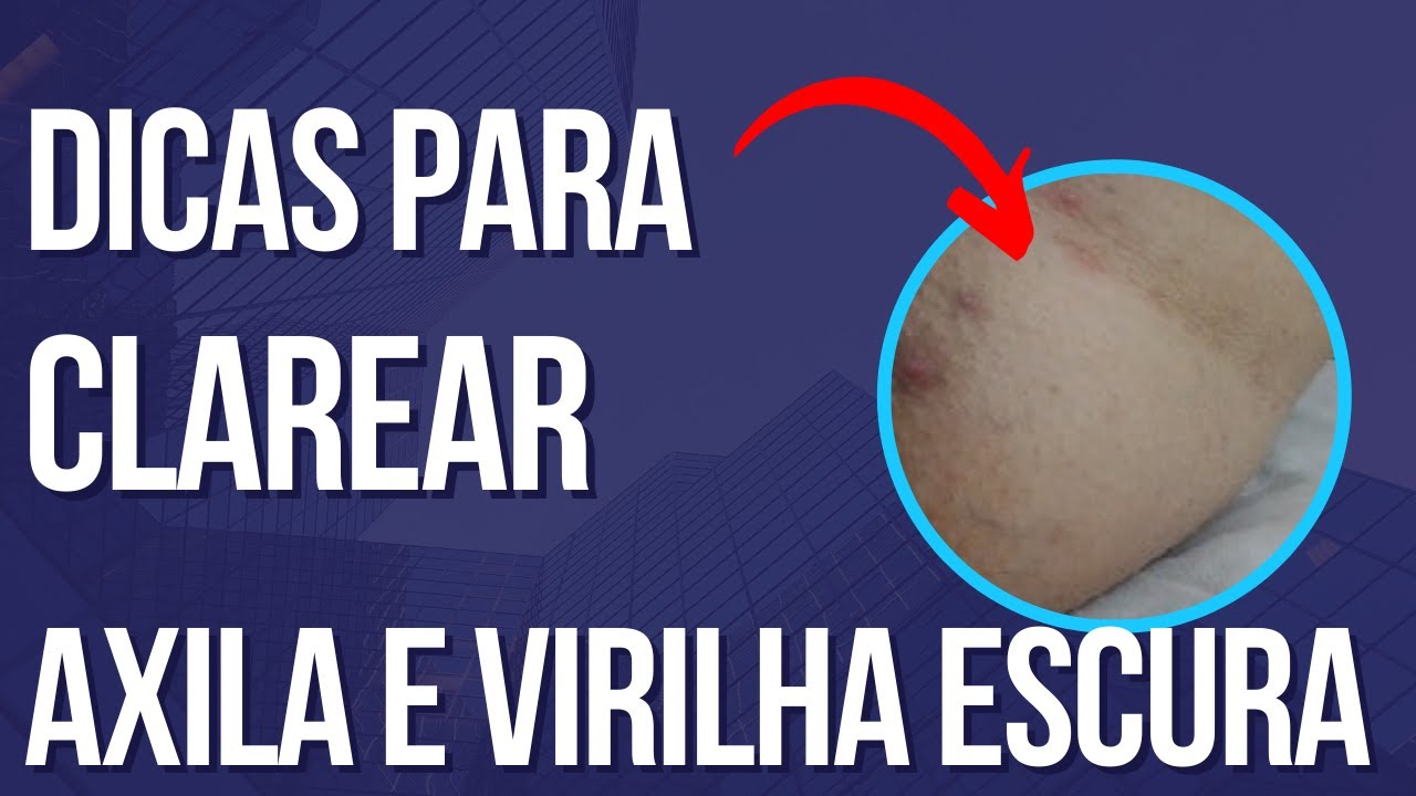 Parte intima escura nunca mais: dicas para clarear de vez em casa.