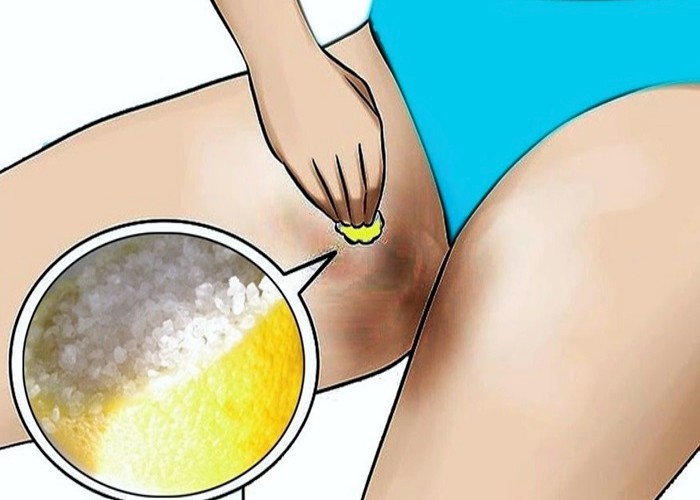 Como eliminar manchas escuras na virilha? 3 métodos simples e eficazes!