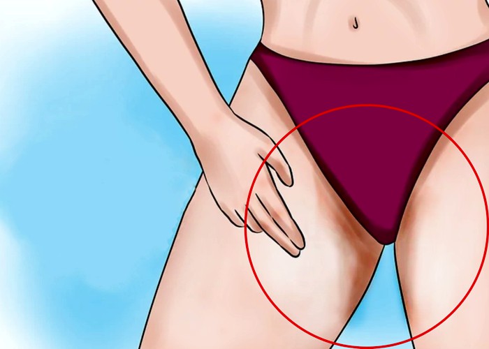 Como eliminar manchas escuras na virilha? 3 métodos simples e eficazes!